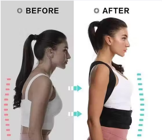 Posture Corrector Belt for Men & Women | Back Brace for Pain Relief, Shoulder Support & Spine Alignment | Adjustable Lycra Back Support Belt — Universal Size